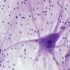 Photo neuronal interfaces